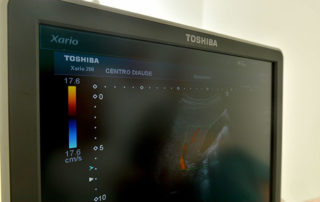 Monitor de ecografia transvaginal